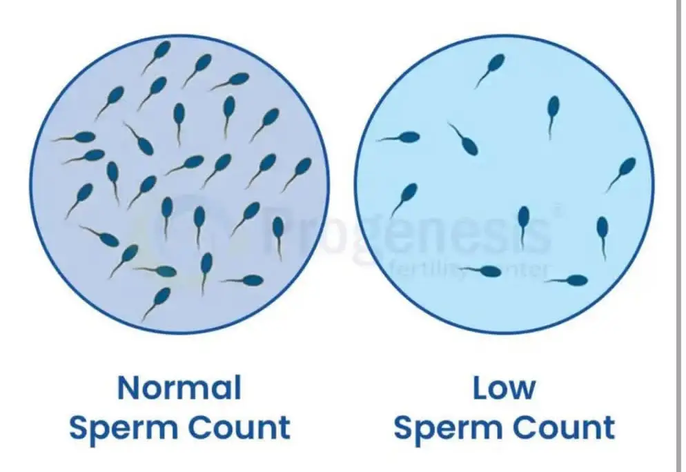 Low Sperm Count in Men